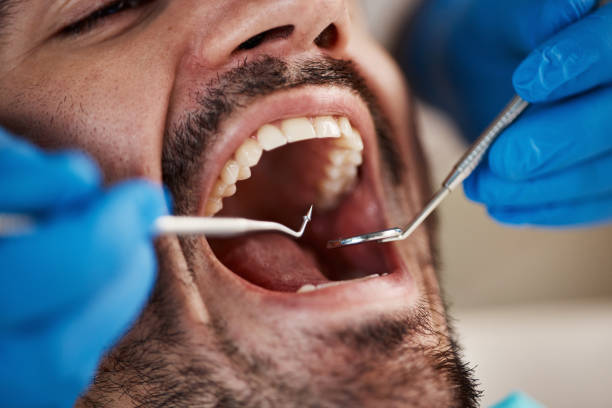 Best Emergency Wisdom Tooth Extraction in Wewahitchka, FL